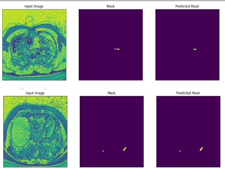 pre-trained resnet-50 backbone