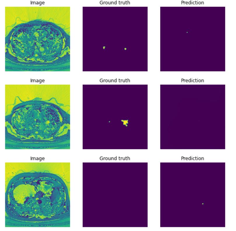 Pulmonary Embolism detection using Computer Vision | Portfolio